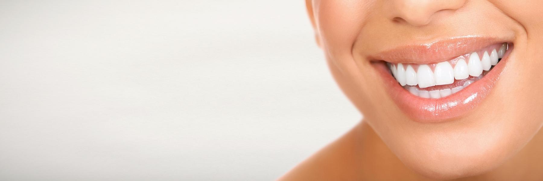 Teeth Whitening | Dentist